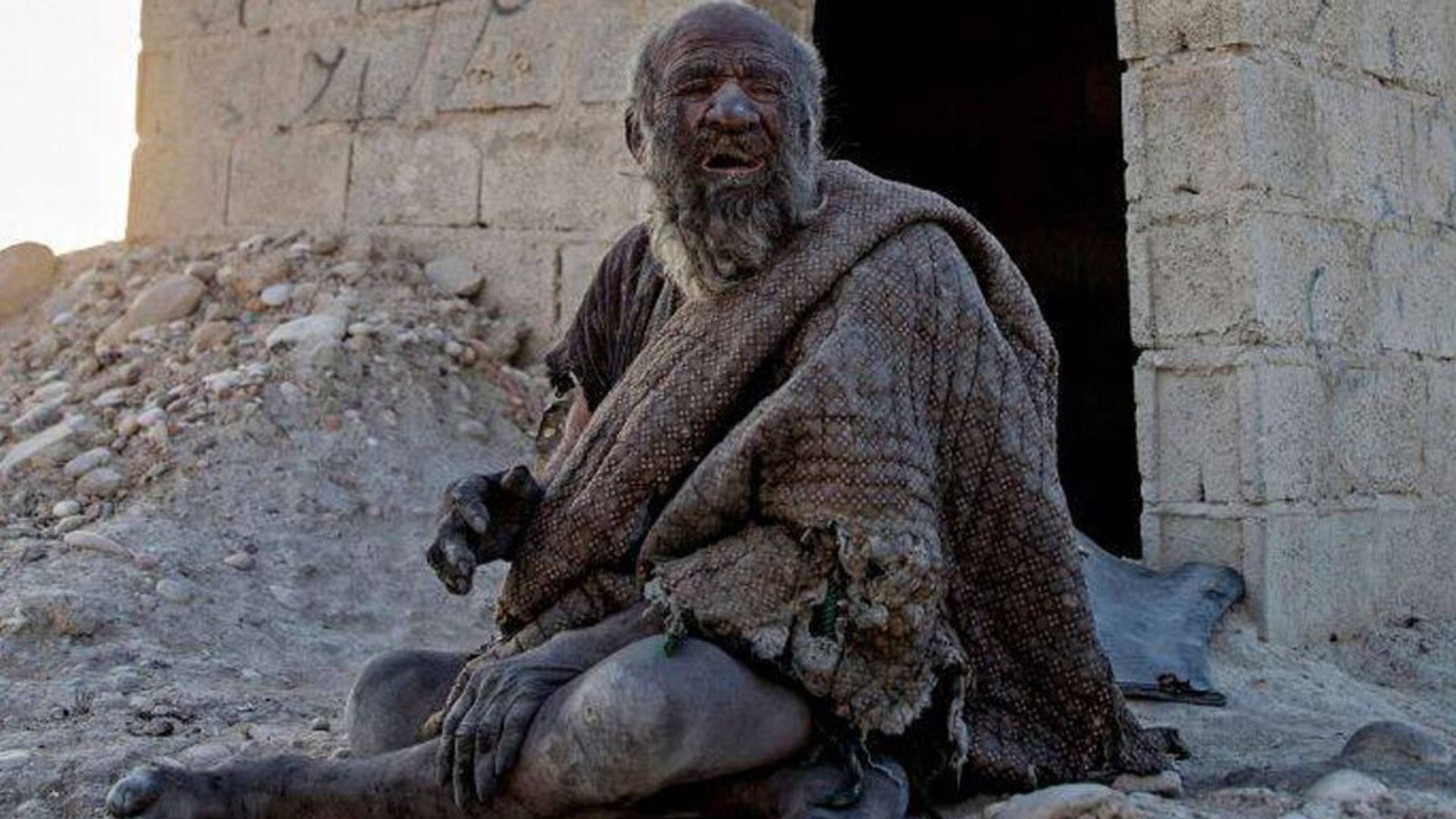 Amou Haji tinha 94 anos e ganhou o título de homem mais sujo do mundo