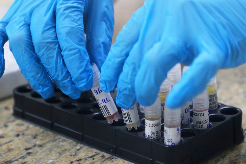 Exames de sangue para detecção da mpox no Amazonas - Foto: Maurício Neto/FVS-RCP