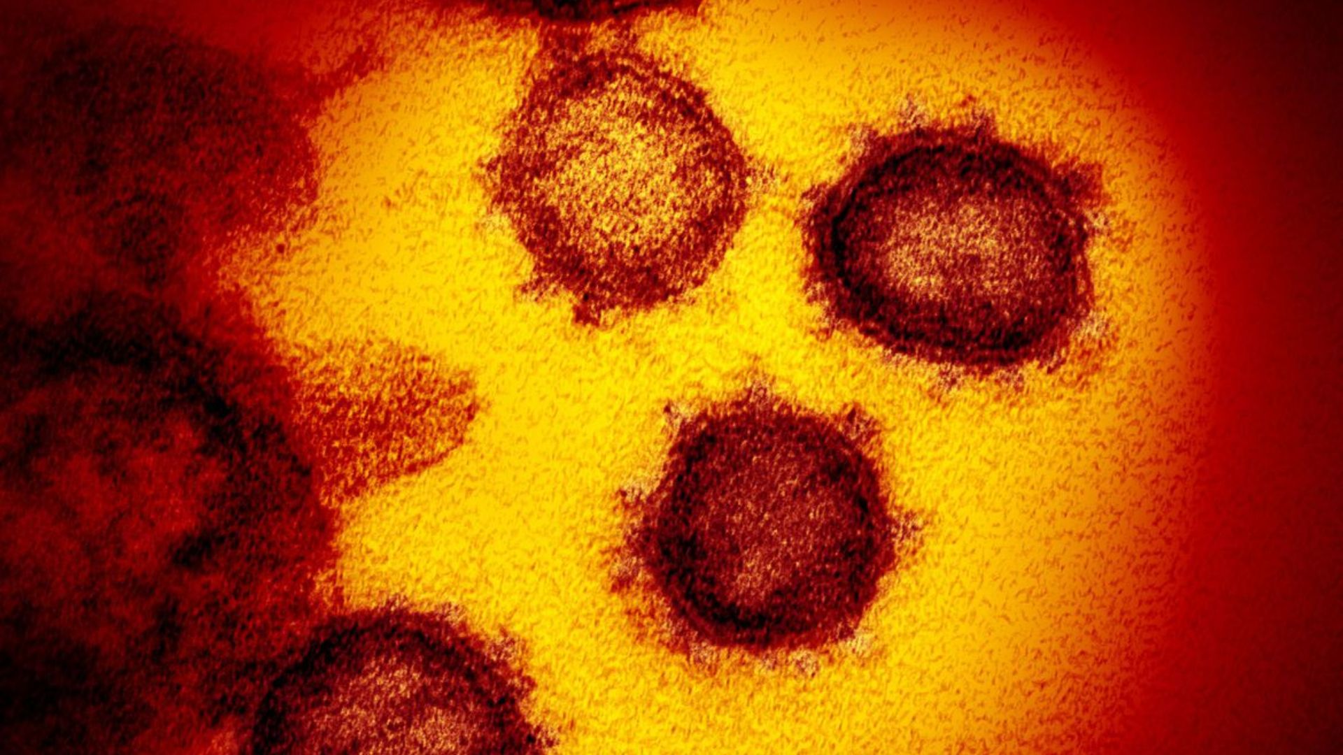 Linhagens do coronavírus - Foto: Divulgação/NIAID