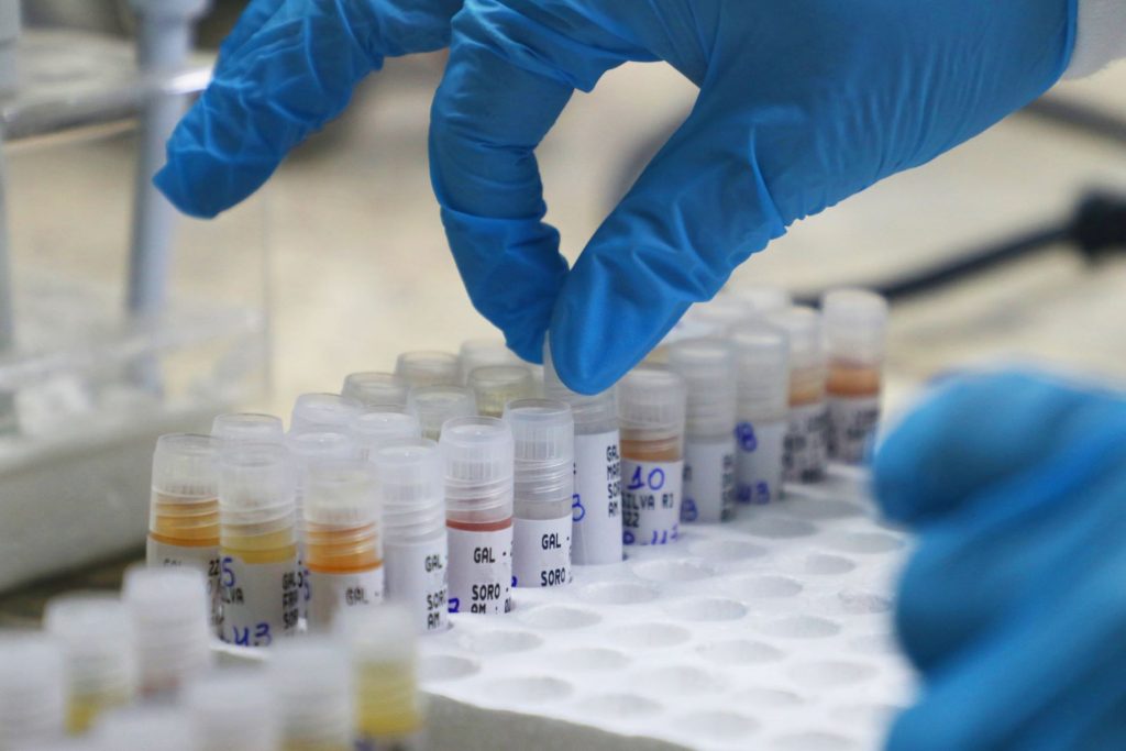 Kits de testagem para monkeypox são disponibilizados pelo Ministério da Saúde - Foto: Maurício Neto/FVS-RCP