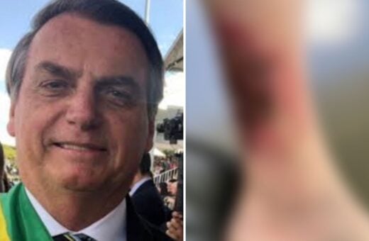 Bolsonaro se recupera de ferimento na perna