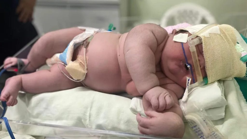Bebê Angerson Santos, nasceu com mais de 7kg na ilha Tupinambarana — Foto: Divulgação/Hospital Padre Colombo