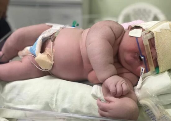 Bebê Angerson Santos, nasceu com mais de 7kg na ilha Tupinambarana — Foto: Divulgação/Hospital Padre Colombo