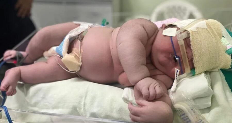 Bebê Angerson Santos, nasceu com mais de 7kg na ilha Tupinambarana — Foto: Divulgação/Hospital Padre Colombo