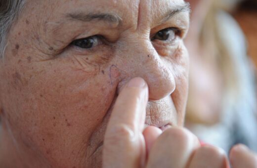 Câncer de pele pode ser prevenido com rotina de cuidados diários e acompanhamento profissional - Foto: Fábio Rodrigues Pozzebom/Agência Brasil