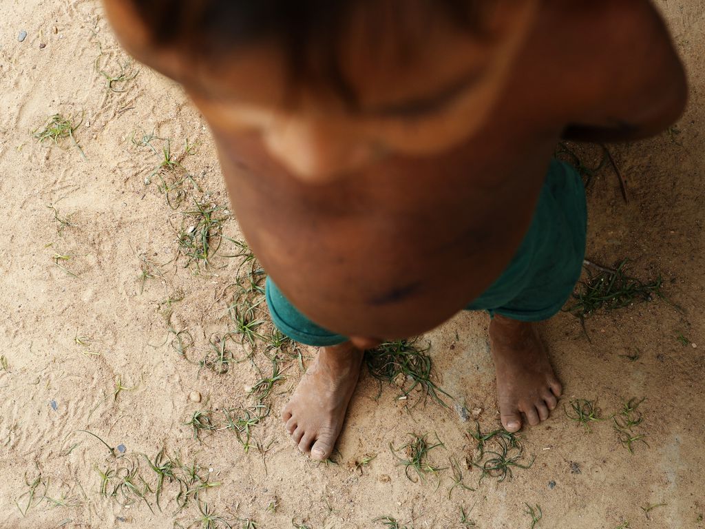 Bebê Yanomami que morreu neste domingo (5) teve desnutrição grave e desidratação - Foto: Fernando Frazão/Agência EBC