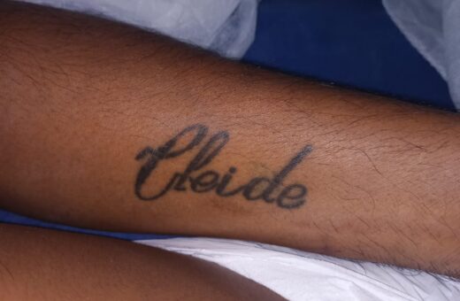 Homem internado tem tatuagem com nome Cleide - Foto: Divulgação/SES-AM