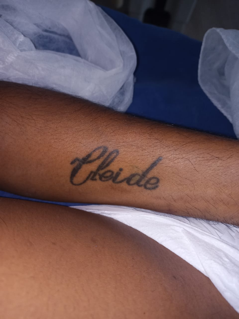 Homem internado tem tatuagem com nome Cleide - Foto: Divulgação/SES-AM
