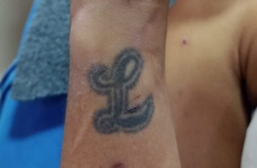 Homem internado no HPS João Lúcio tem tatuagem com a letra "L" - Foto: Divulgação/SES