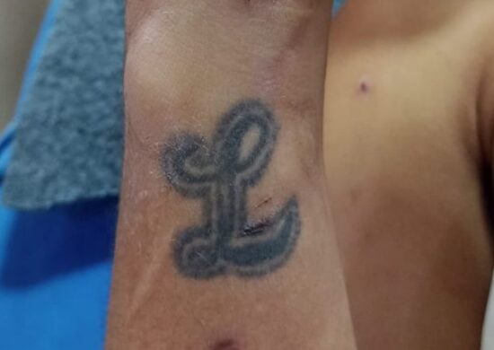 Homem internado no HPS João Lúcio tem tatuagem com a letra "L" - Foto: Divulgação/SES