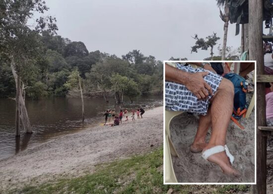 O ataque das piranhas aconteceu em um balneário na Zona Oeste de Manaus - Foto: Reprodução/Whatsapp