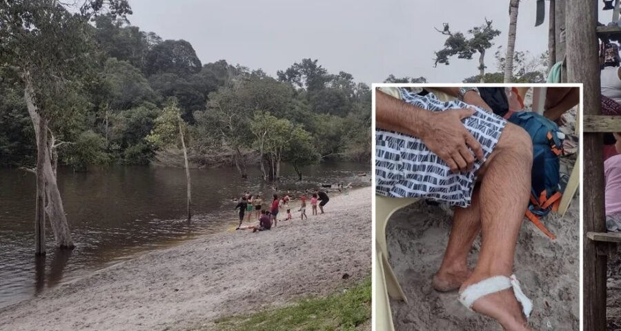 O ataque das piranhas aconteceu em um balneário na Zona Oeste de Manaus - Foto: Reprodução/Whatsapp