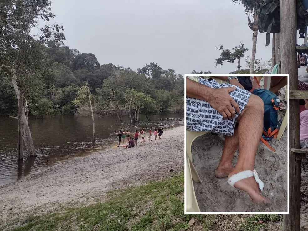 O ataque das piranhas aconteceu em um balneário na Zona Oeste de Manaus - Foto: Reprodução/Whatsapp