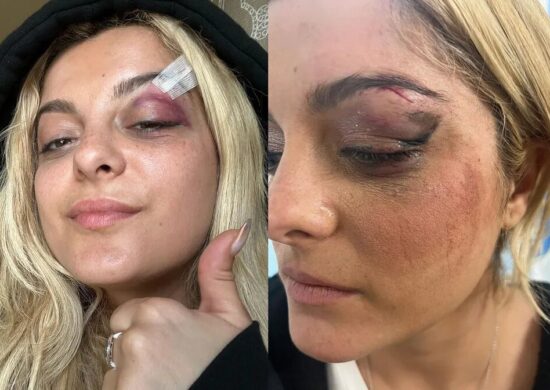 Bebe Rexha precisou sair do palco depois de ser atingida por um celular durante sua apresentação em Nova York - Foto: Reprodução/Instagram/@beberexha