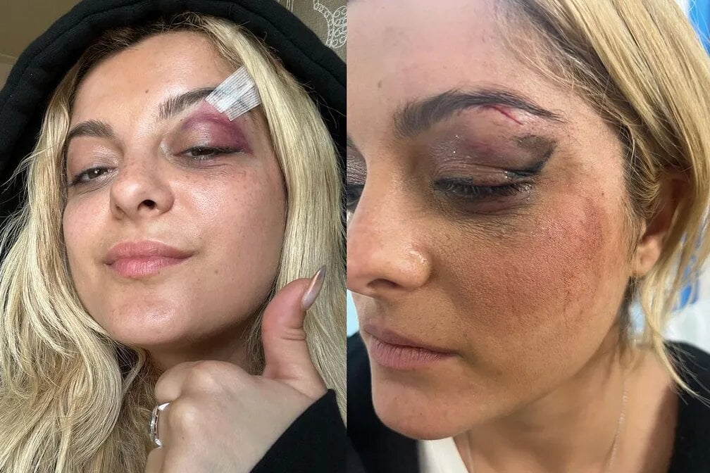 Bebe Rexha precisou sair do palco depois de ser atingida por um celular durante sua apresentação em Nova York - Foto: Reprodução/Instagram/@beberexha