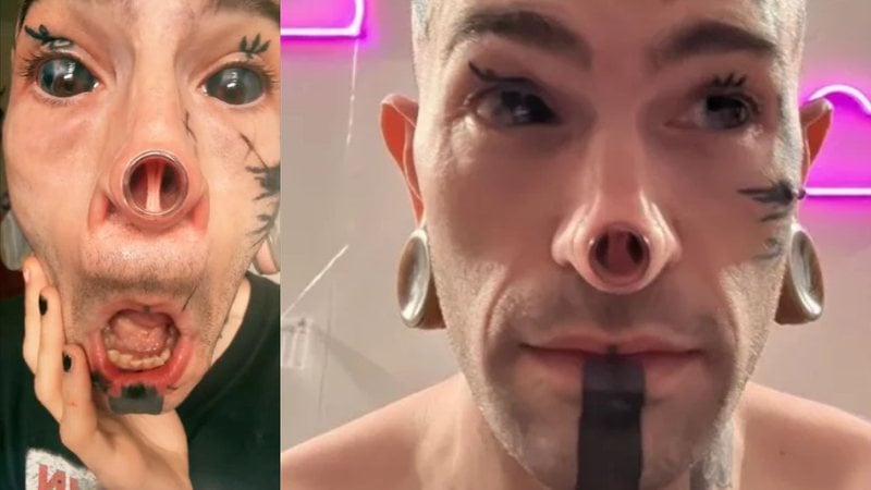 Americano removeu a ponta do nariz - Foto: Reprodução/Instagram @odinbody