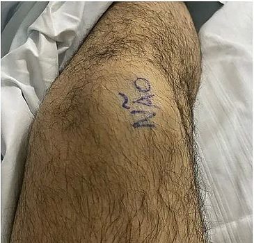 Paciente escreve 'sim' e 'não' nos joelhos para marcar antes de cirurgia