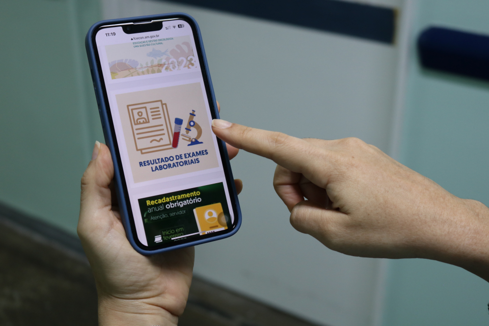 Usuário recebe código para acessar resultado dos exames - Foto: Ludmila Dias/FCecon