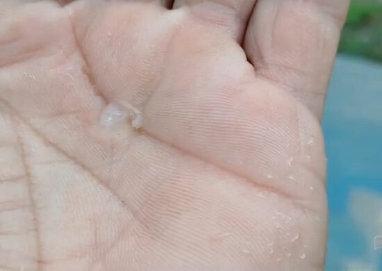 VÍDEO imagens mostram chuva de granizo em Manaus