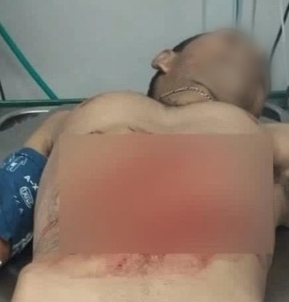 Homem de 41 anos morre em troca de tiros com a Polícia em Roraima