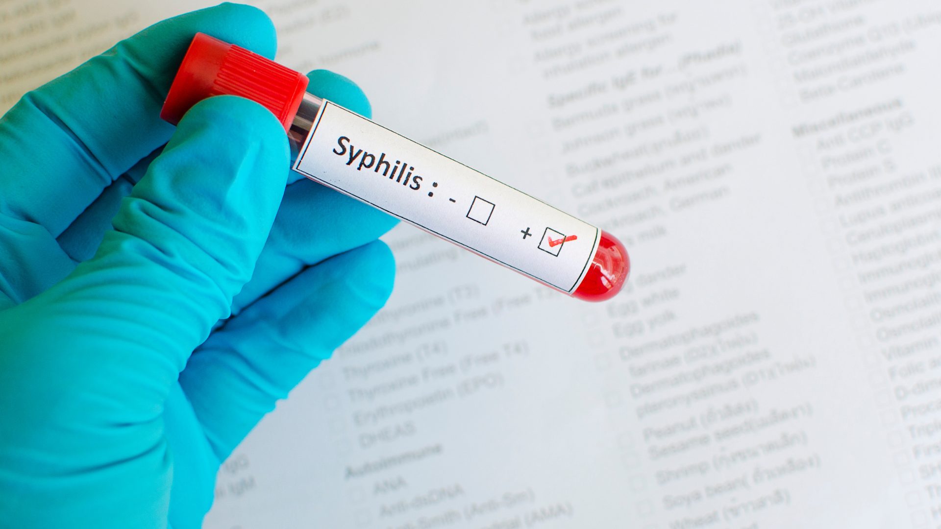 Campanha Outubro Verde alerta para prevenção e combate à Sífilis