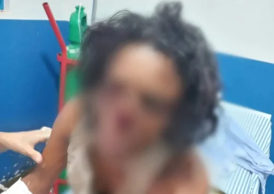 Mulher perde nariz em tentativa de feminicídio em Colmeia-TO