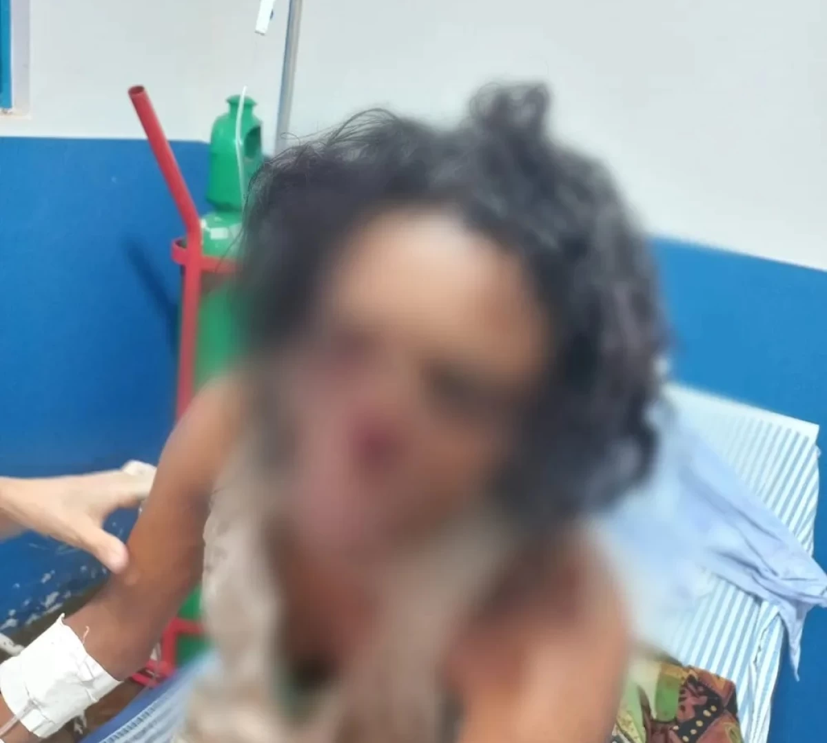 Mulher perde nariz em tentativa de feminicídio em Colmeia-TO