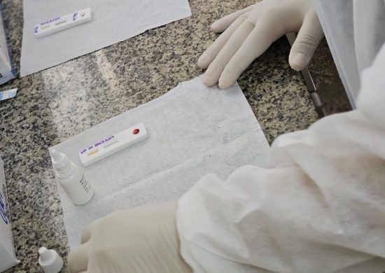 Teste rápido para detectar anticorpos da hanseníase é disponibilizado em Manaus