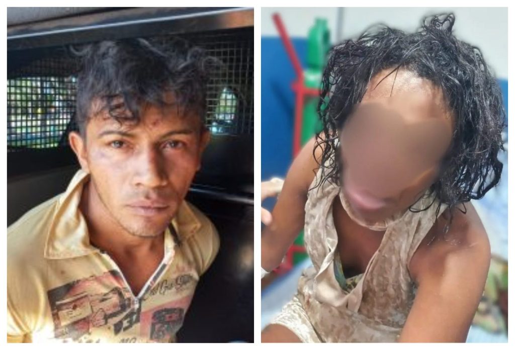 Além de ferimentos no nariz, mulher teve couro cabeludo arrancado pelo agressor - Foto: Reprodução/WhatsApp