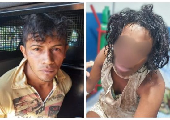 Além de ferimentos no nariz, mulher teve couro cabeludo arrancado pelo agressor - Foto: Reprodução/WhatsApp
