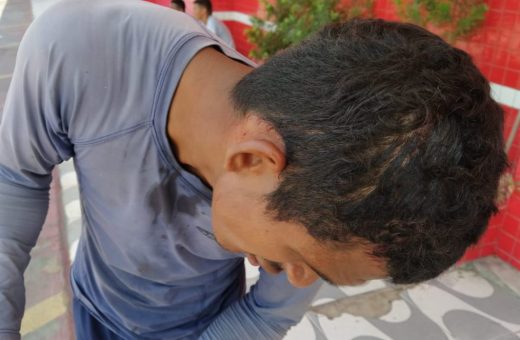 Homem agredido na cabeça se naga a prestar queixa em Boa Vista - Foto: Taígo Araújo