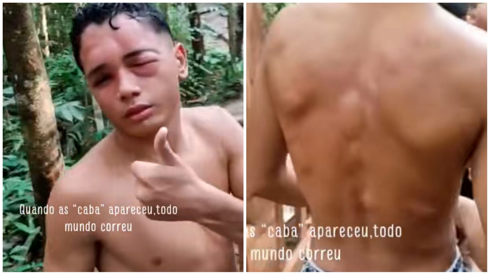 video-jovem-atacado-cabas-presidente-figueiredo-foto-reprodcao-tiktok-thailsonbjj