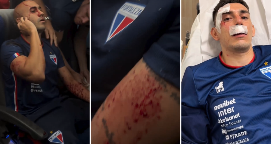 Seis jogadores foram atingindos durante ataque de torcedores do Sport - Foto: Reprodução/Instagram @tgalhardo @marcelopaz