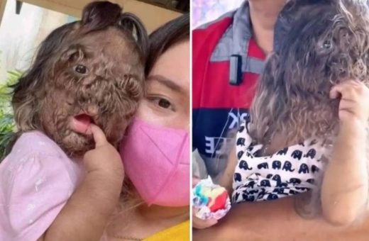 Garota de dois anos sofre com condição que não tem cura
