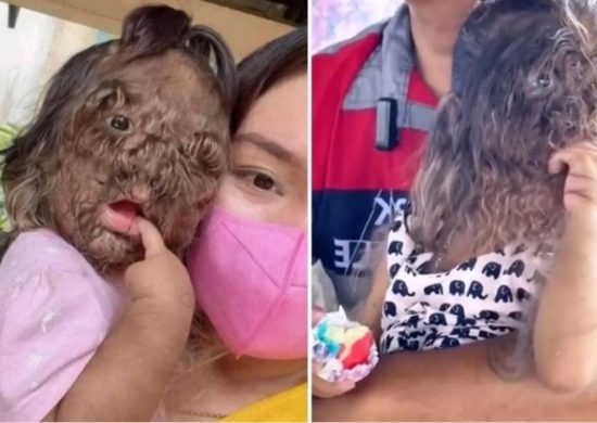 Garota de dois anos sofre com condição que não tem cura