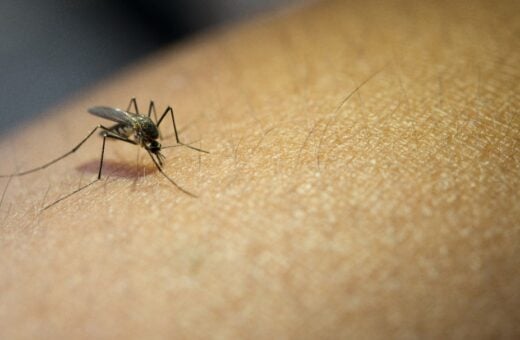 malária em roraima