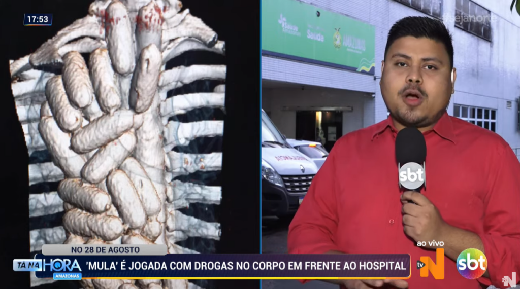 Mulher foi deixada em frente ao Hospital e Pronto-Socorro 28 de Agosto com cápsulas de cocaína no intestino - Foto: Reprodução/TV Norte Amazonas