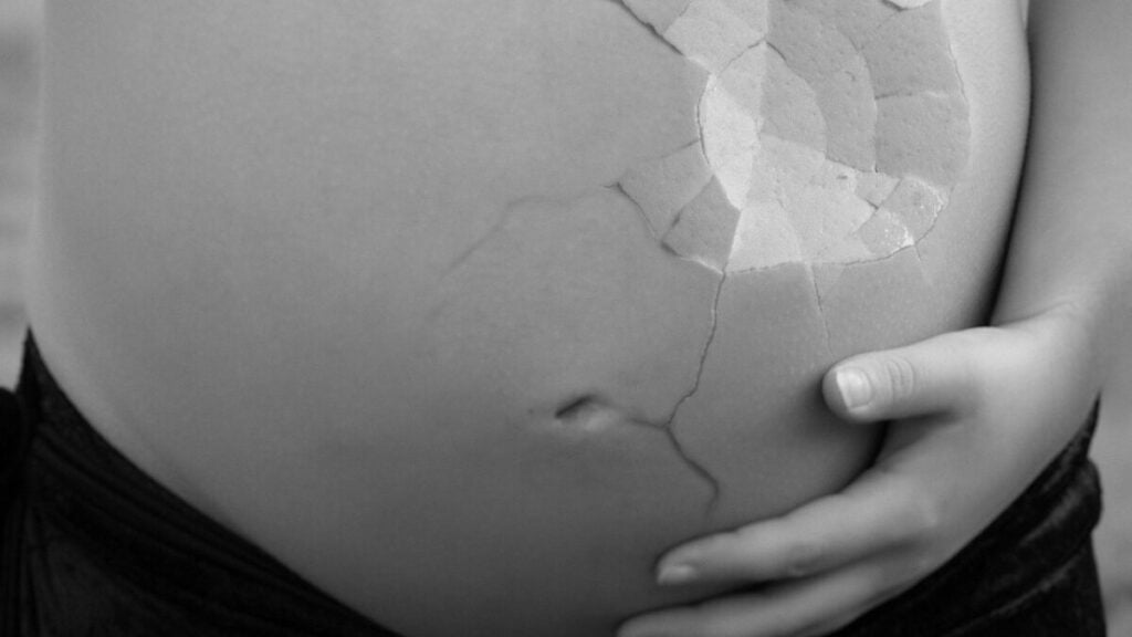 Aborto legal no SUS é debatido por pesquisadores - Foto: Banco de Imagens/Pixabay