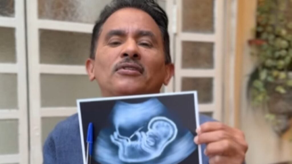 Manoel Gomes afirma que será pai - Foto: Reprodução/Instagram